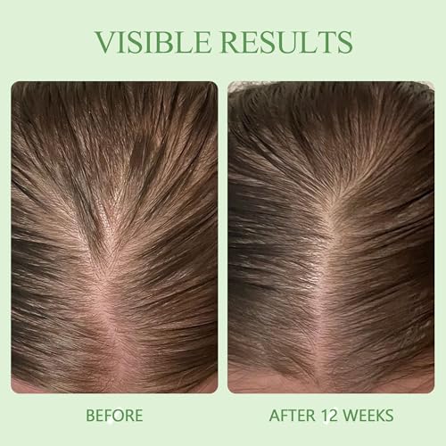 Scalp Serum for Women w/Biotin & Caffeine to Promote Fuller-Looking Hair 1.69 Fl Oz (Pack of 2)