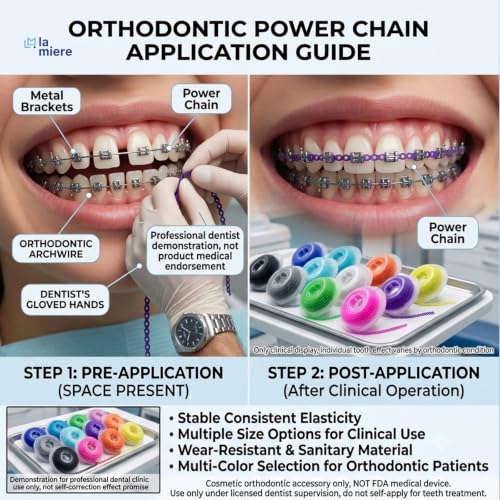 10 Rolls Orthodontic Braces Rubber Chains, Braces Power Chains consisted force in closed, short, long filaments chain in 15''spools (closed, 0.113’’(2.5mm) Mix colors closed, 0.113’’(2.5mm)