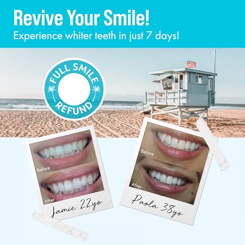 Cali White Teeth Whitening Gel Refills - 35% Carbamide Peroxide Formula - Vegan Organic Tooth Bleach - 3-Piece 5 ml Syringes for Teeth Whitening Kits - Use with UV or LED Light and Trays 0.17 Fl Oz (Pack of 3) 3 x 5ml Gel Refills