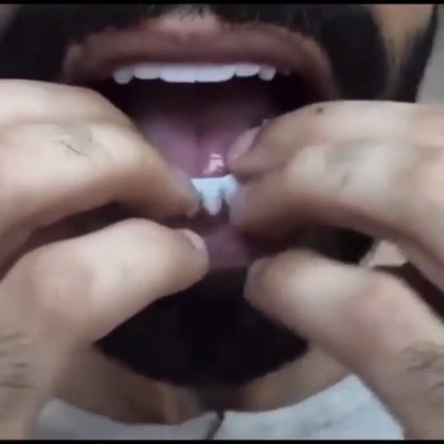 2 Pairs Snap on Dentures for Women & Men, Comfortable & Confident Smile, Snap in Teeth for Missing Teeth