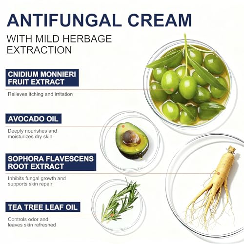 Antifungal Cream for Jock Itch, Athletes Foot & Ringworm - 2% Miconazole Nitrate Cream for Humans Skin Fungus, Relieves Itching, Burning, Cracking and Scaling (3.5 Ounce) 3.5 Ounce