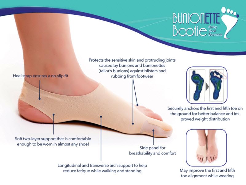 Tailors Bunion Corrector, Bunionette Relief Pinky Toe Sleeve. Med, Left Medium (Pack of 1)