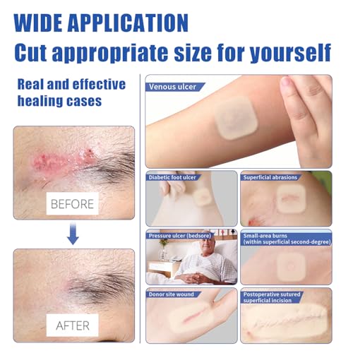 Hydrocolloid Bandages 4"x4",10 Packs, Waterproof Self‑Adhesive Pad 4IN * 4IN-10 PCS