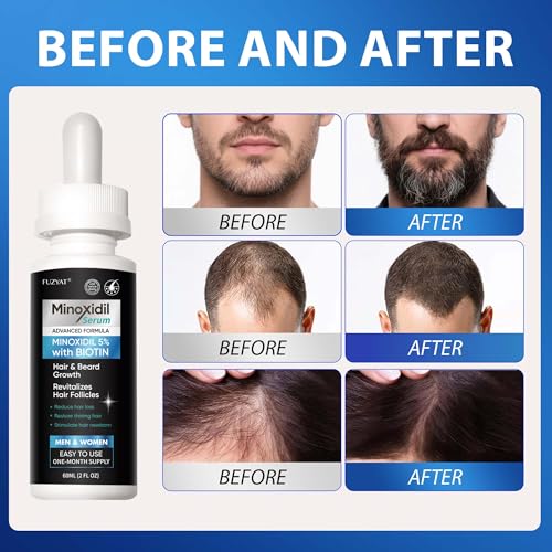 5% Minoxidil for Men, Minoxidil for Women Hair Growth Treatment, Beard Growth Serum, Biotin & Castor Oil Enriched,Strengthens Weak Roots, Repairs Thinning Hair (120ml) 2 Fl Oz (Pack of 2)
