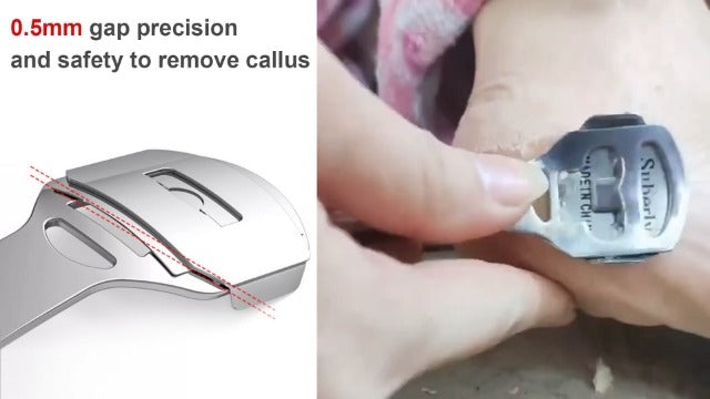 36 Pcs Callus Shaver for Feet Set, Foot Callus Shaver, (1 Stainless Foot File &1 Foot File Heads & 4 Pedicure Knife & 30 Replacement Slices Blades) B-set