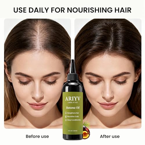 Organic Raw Batana Oil for Hair & Scalp - Pure Unrefined Batana Butter for Hair Volume, Deep Nourishment & Anti-Breakage - Natural Moisture Repair Care for Dry Damaged Hair, 4.06 fl oz