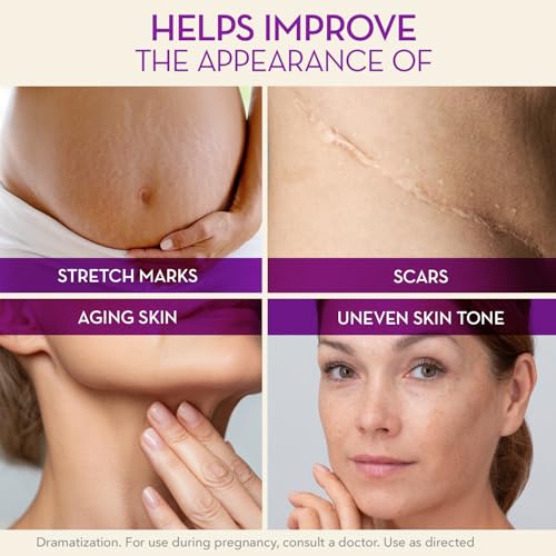 Cicatricure Cica Oil for Stretch Marks & Scars, Body Oil, 6.7 fl oz 6.7 Fl Oz (Pack of 1)