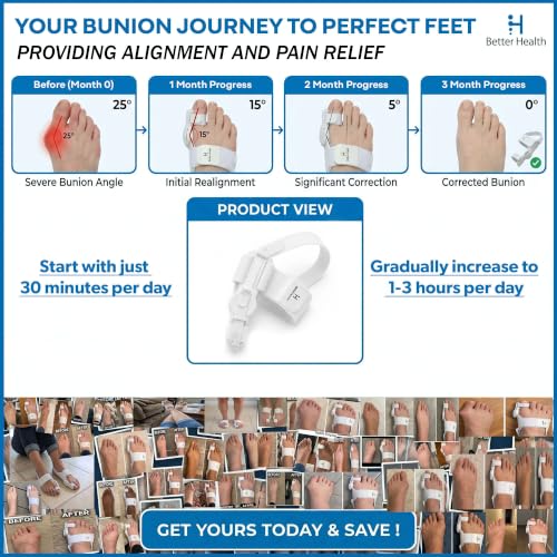 2026 Bunion Corrector for Women & Men, Fully Adjustable Orthopedic Bunion Fix, Big Toe Separator, Day/Night Support, Ergonomic Bunion Splint Hammer Toe Straightener (2PCS) Gray