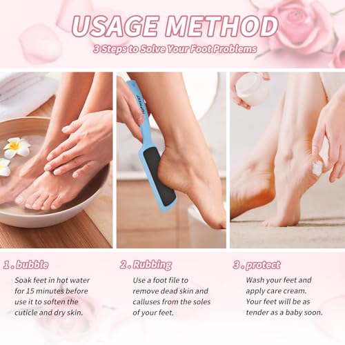 Topmeet Foot File for Dead Skin - Dual Sided Foot Rasp Callus Removers, Professional Pedicure Tool for Soft, Smooth Feet (Blue) Blue