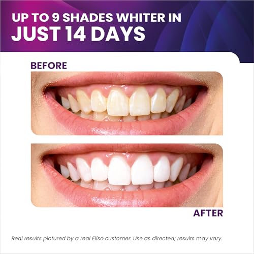 eliso Teeth Whitening Strips - 21 Treatments - 42 Strips - Peroxide Free - Enamel Safe for Whiter Teeth - Whitening Without The Sensitivity-Confident Smiles, Every Day