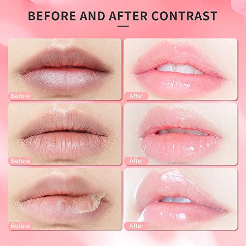 Lip Scrub, Lip Scrubs Exfoliator Moisturizer Dr.YIMAN Sugar Lip Scrub, Lip Exfoliator Scrub for Dry and Chapped Lips,Anti-Aging and Temping, Lip Mask, Lip Care Products, Lip Scrubber, Lip Moisturizer Strawberry