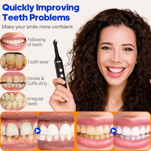 Tooth Polisher, RRZIOM Teeth Cleaning Kit with 5 Heads, 5 Modes, 4 Pastes Black-1