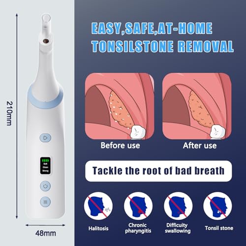 Electric Tonsil Stone Remover with Camera, 3 Suction Levels Vacuum Kit, USB Rechargeable Oral Care for Tonsil Stone Removal（White） White