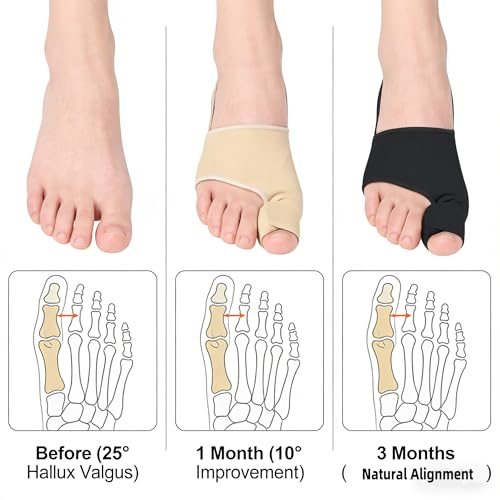 Bunion Corrector for Women & Men, Big Toe, Black, 2PCS