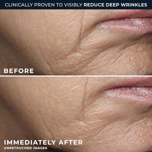 RoC Deep Wrinkle Rich Cream, Daily Anti-Aging Firming Cream, fragrance-free
