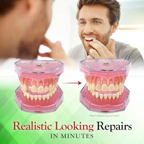 SmileFix Basic Dental Repair for Missing or Damaged Teeth - Fix Gaps, Missing Teeth, Spaces, Broken Tooth - Fast & Easy - Confident Smiles - Durable Compound - Thermoplastic Beads