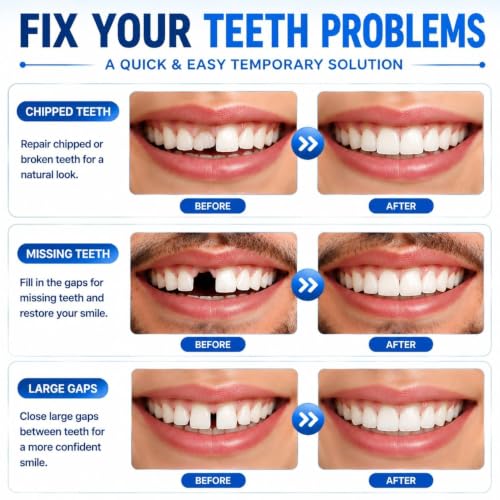 Sukh 10.9oz Moldable False Teeth Beads - Tooth Repair Kit,Repair Thermoplastic Beads,Plastic Pellets for DIY Tooth Filling,Halloween Vampire Teeth Fangs Ideal for Chipped, Cracked