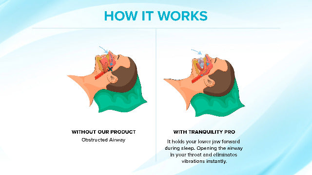 Tranquility PRO 2.0 Anti-Snoring Mouth Guard - Adjustable Mouthpiece - Night Time Mouthguard Stop Snore