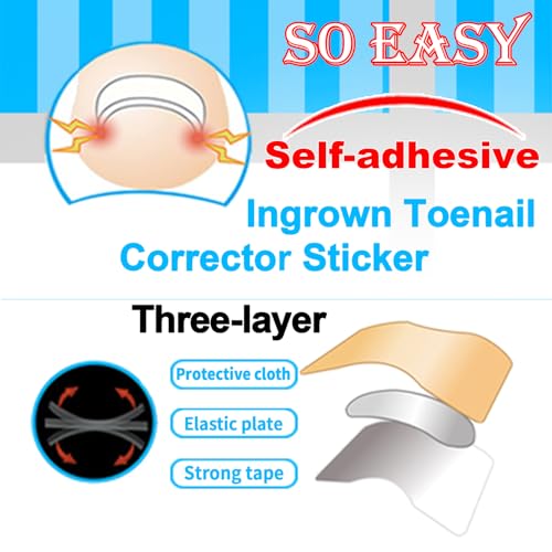 Professional Ingrown Toenail Correction Kit, Pedicure Care Tools