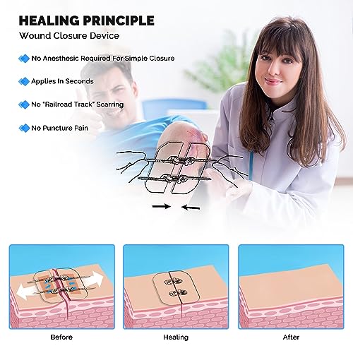 Emergency Wound Closure Strips - 2Pcs Zip Stitch Laceration Closure Kit Closures Repair Wounds Without Stitches - Butterfly Bandages for Wounds 2 Pcs Sets