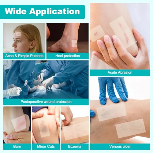 Hydrocolloid Roll for Wound Care, Hydrocolloid Bandages with Self-Adhesive, Cut-to-Size Patch Bandages, Ultra Absorbent, Waterproof, First Aid Kit Essential (2IN*4.8FT) 2IN*4.8FT