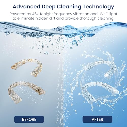 Rechargeable Ultrasonic Retainer Cleaner, 45kHz Portable Deep Cleaning Pod, Gentle Dental Cleaner for Aligners, Mouth Guards, Night Guards & Braces, Digital Timer with 4 Cleaning Modes