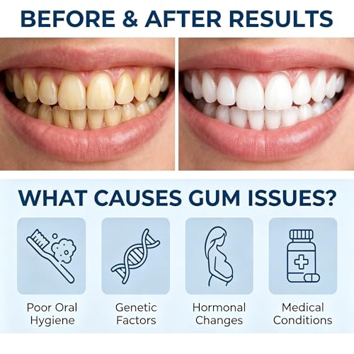 Gum Repair Gel for Receding Gums, Professional Daily Oral Care Essence Pen for Sensitive Teeth & Enamel Safety, Natural Plant Extract Gentle Gum Support Formula (3 Pack) 3 Pack