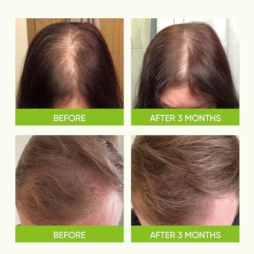 Svvimer Hair Boost Spray - with Rosemary Batana Oil Biotin for Hair Loss and Thinning - Thicker Fuller Longer - for Women and Men 2.7 Fl Oz (Pack of 1)" since unit on hand is Hair Boost Spray. 2.7 Count (Pack of 1)
