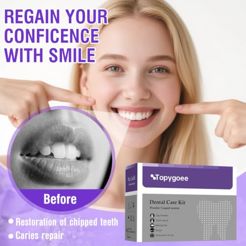 Tooth Repair Kit, Zinc Oxide Eugenol Dental Cement for Broken Teeth Purple