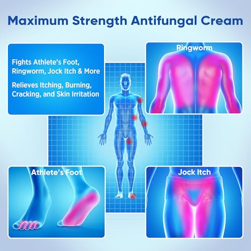 AOSORW Antifungal Cream for Jock Itch - Miconazole Anti Fungal Cream for Itchy Skin Relief Extra Strength - Ringworm Treatment for Humans - Athlete's Foot Treatment - 4.2 oz (120g)