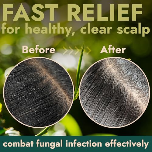 Tea Tree Scalp Scrub with Tea Tree Oil for Itchy & Dry Scalp, Reduce Flakes Pack of 1