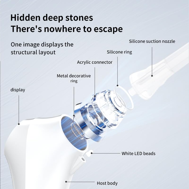 Electric Tonsil Stone Remover, 6 Suction Modes, 6-in-1 Probes & Ultra-Bright LED, Tonsil Stone Vacuum Kit with Food-Grade Silicone Tips, Painless Cleaning for Fresh Breath,Rechargeable & Waterproof M