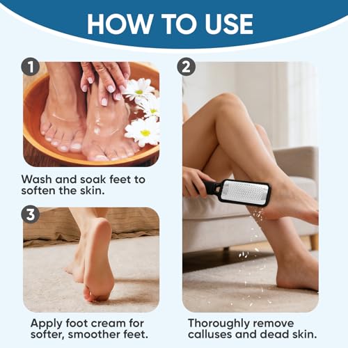 TEAWOO 3 Pack Foot Files Callus Remover, Stainless Steel Foot Rasp and Foot Scrubber, Professional Pedicure Tools for Dead Skin, Hard Skin and Calluses Removal 3p