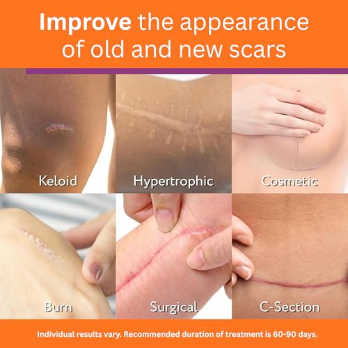 Abera Scar Cream - Advanced Nano Formula for New and Old Scars - Effective for Keloids, Stretch Marks, Surgical Scars, and Acne Marks - Restores Smooth-Looking Skin (1 Box) 1 Box