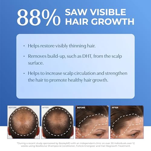 BosleyMD Revive Thickening Treatment for Thinning Hair – DHT Blocker Leave-In Scalp Treatment with Rosemary, Saw Palmetto & Pumpkin Seed – Volumizing, Strengthening, Non-Color Treated Hair – 3.4 fl oz Thickening Treatment -Rosemary