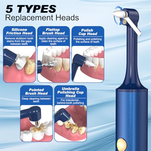 Tooth Polisher, Tooth Whitening Kit for Teeth Cleaning and Whitening, Rechargeable Teeth Polisher for People/Pets,Teeth Cleaning Kit with 5 Brush Heads,4 Speed Modes and LED Light, Waterproof(Blue) Blue