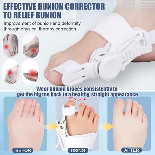 Bunion Corrector for Women & Men - Adjustable Nighttime Big Toe Straightener Bunions Splint with ABS Support for Hallux Valgus Relief Hammer Toe Brace Sleeping Home Use Left/Right Feet - 1PC Black 1