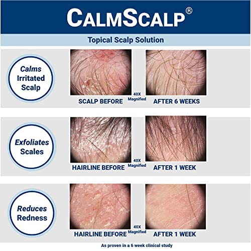 Leave-In Scalp Serum 4 Ounce
