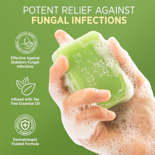 Roycederm Antifungal Bar Soap - Tea tree Oil Soap - Athlete’s Foot Treatment for Jock Itch & Ringworm - Medicated Antifungal Soap with Clotrimazole 1% - Tea Tree Oil Scent, 1 Pack 4 Ounce (Pack of 2)