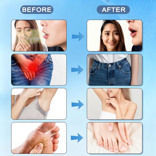 Zero Breath Bad Breath Capsules, 7-in-1 Body Deodorizing Supplement, with Chlorophyllin, Mint Extract, Probiotic Blend, Oral Freshness in 14 Days 1