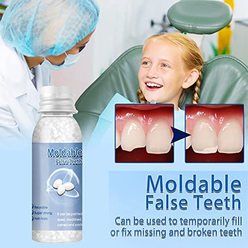 Tooth Repair Kit, Temporary Restoration of Missing & Broken Teeth, 1Pcs 30ml*1