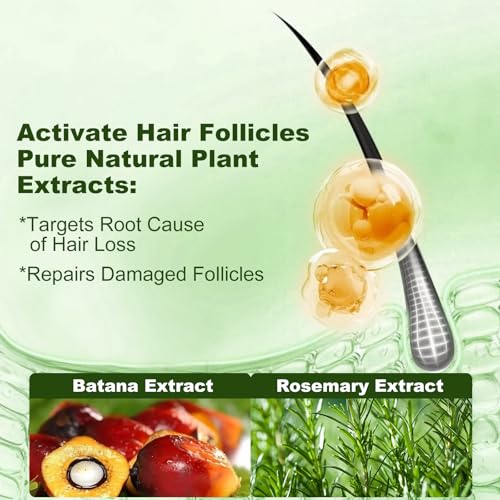 Tgideas Batana Oil Rosemary Shampoo for Hair Growth, Thinning Hair, 2 Pack