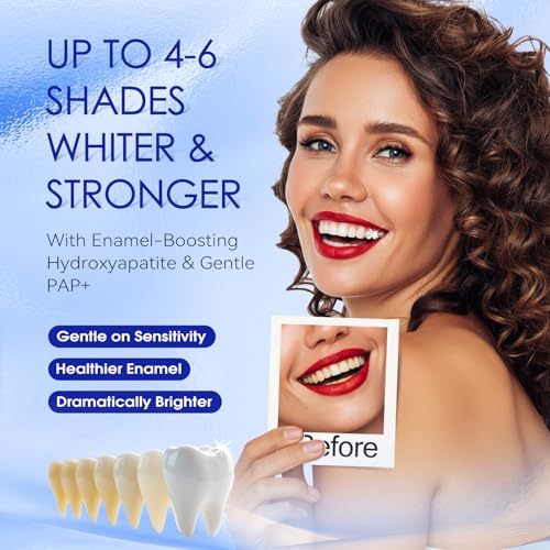 Teeth Whitening Kit - Gel & Mouthpiece Set, Dentist Formulated for Sensitive Teeth