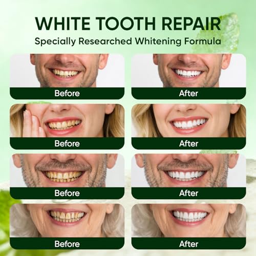 Oral Care Remineralizing Tooth Powder, Fluoride-Free Hydroxyapatite Whitening Tooth Powder Whitening for Enamel Support & Strong Teeth,Gently Cleans Oral Care&Fresh Breath (1) 1