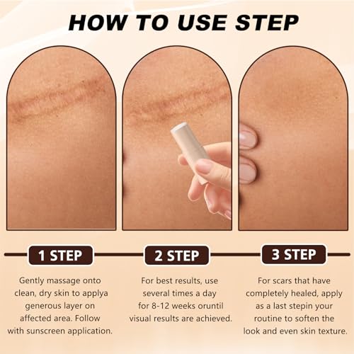 2pcs Scar Solutions Silicone Scar Stick, Made of 60% Silicone, Lightweight & Easy to Apply, Gentle on All Skin Types