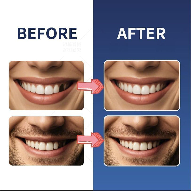 Tooth Repair Kit，Temporary Natural Shade for Filling The Gap