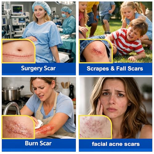 Morovan silicone scar removal Gel: Scar cream for Body and face Effectively minimizes the appearance of Scars from Stretch Marks Surgical Scar Keloids Acne Burns and Other, New scar 6 weeks