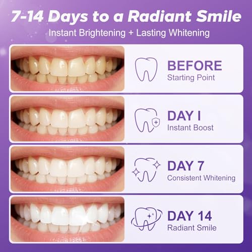 Purple Teeth Whitening Strips for Sensitive Teeth 28 Count Whitener Strips Upgraded Purple 1 Count (Pack of 28)