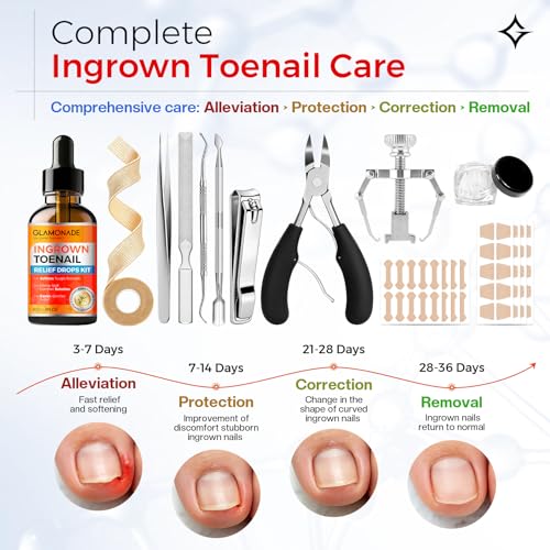 Glamonade Ingrown Toenail Removal Kit: Complete Ingrown Toenail Tool With Corrector Patch And Relief Softening Drops For Soothing Comfort, At‑Home Professional Kit For Men & Women with Curved Toenails 13 Pcs