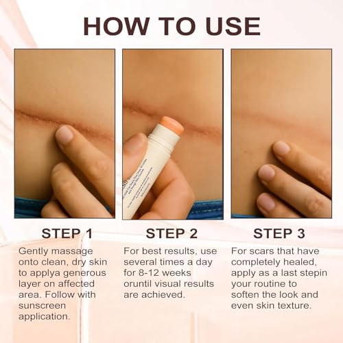 Silicone Scar Stick, Scar Removal Cream, Lightweight Silicone Balm,Smoothing Cream for Scars, Hyaluronic Acid & Algae Extract Easy-to-Use Scar Care Stick for Smoother Looking Skin (2PCS-30g